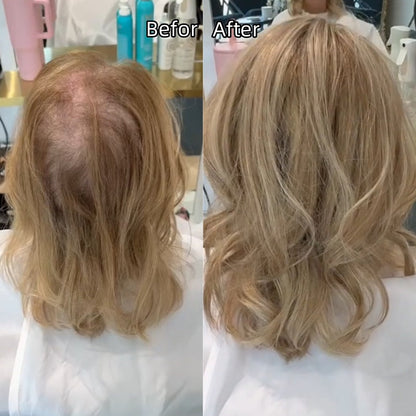 Designed For Women With Thinning Hair ✨ Feel Like Yourself Again