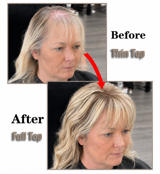 Designed For Women With Thinning Hair ✨ Feel Like Yourself Again